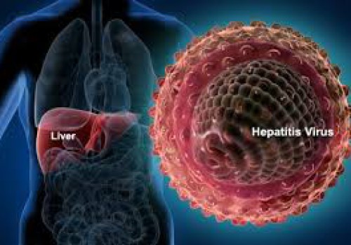 هر ۳۰ ثانیه یک قربانی با بیماری‌های مرتبط با هپاتیت